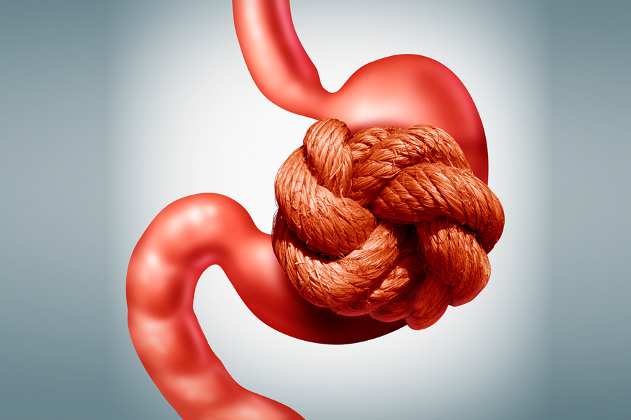 efectos secundarios de la funduplicatura