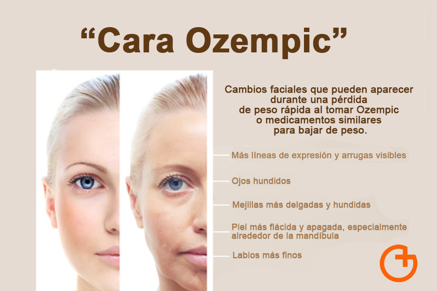 ¿Tienes Ozempic face? Se refiere los cambios en el rostro que presentar algunas personas que se refiere la percepción de una apariencia envejecida  