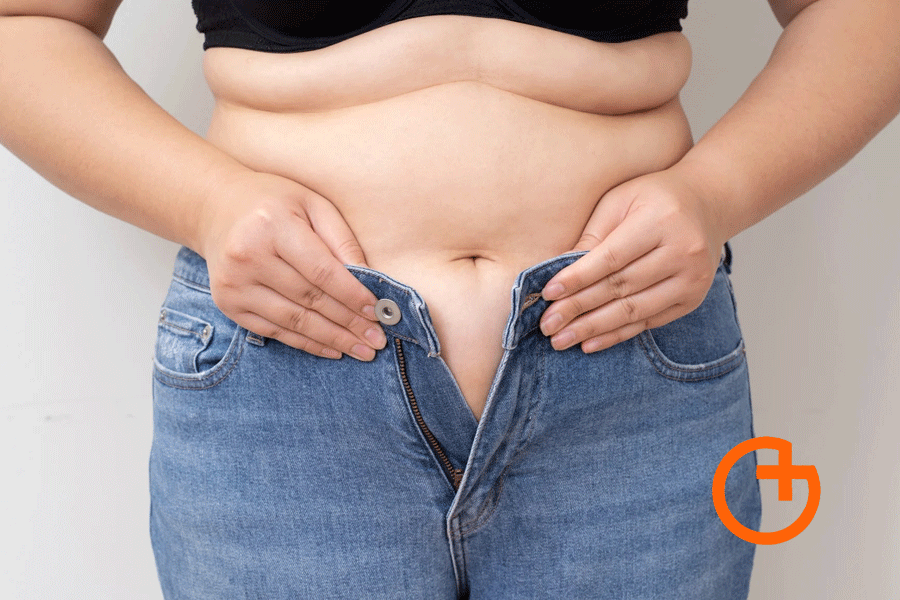 La distension abdominal habitualmente se asocia con aumento del perimetro abdominal