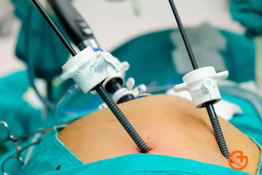 riesgos de la cirugia de la obesidad