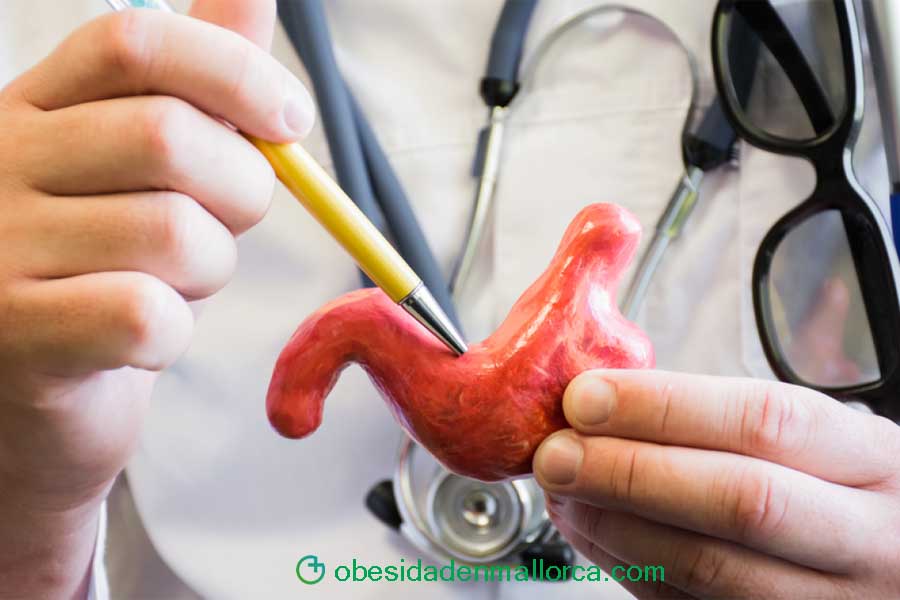 Y después de la cirugía qué?