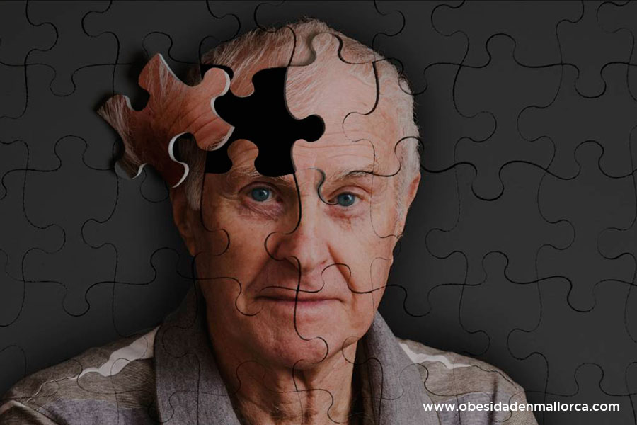 La obesidad: un factor de riesgo de Alzheimer