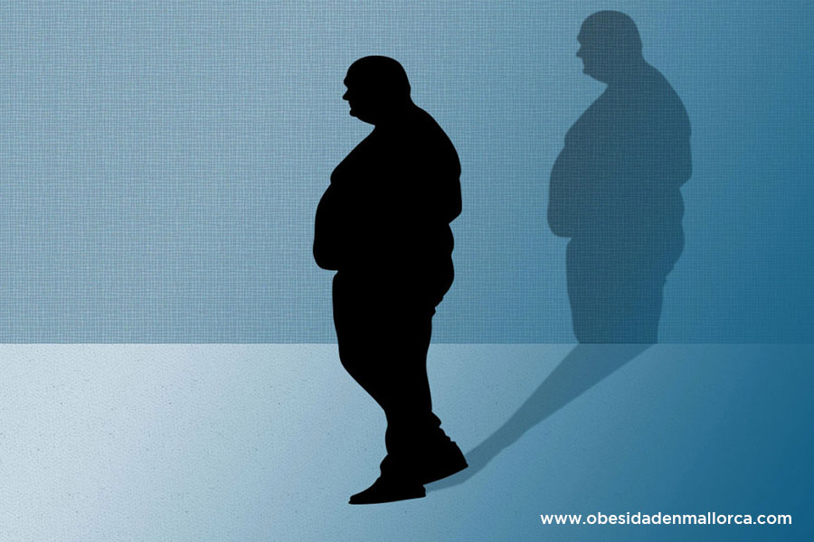 El peso psicológico tras una reducción de estómago