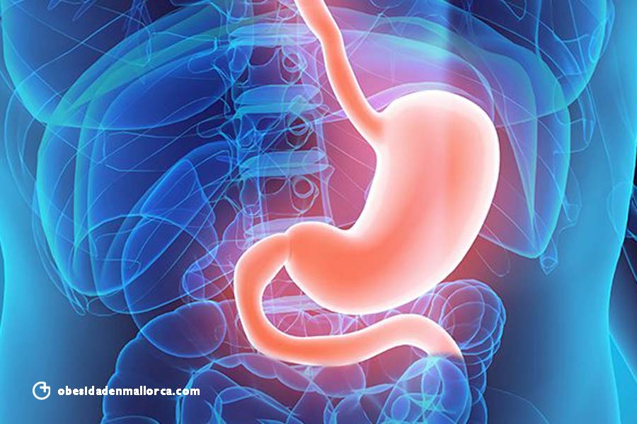 Recomendaciones dietéticas tras una gastrectomía