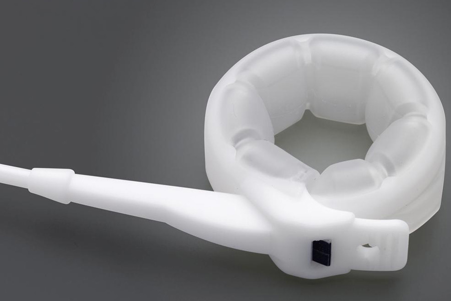 ¿Existe indicación para la banda gástrica?