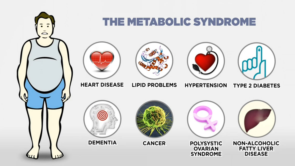 ¿Qué es el síndrome metabólico? 