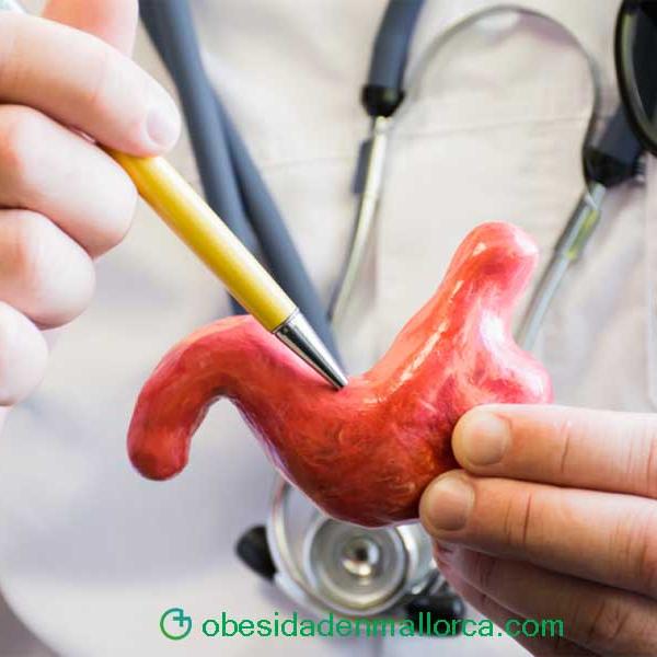 ¿Cuál es el proceso de una operación laparoscópica?